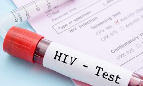 Xét nghiệm máu để là test thường dùng để xác định bệnh HIV