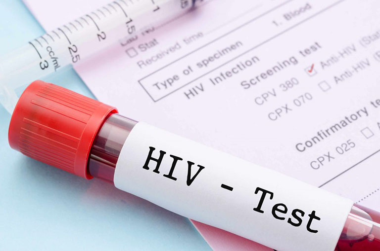Xét nghiệm máu để là test thường dùng để xác định bệnh HIV