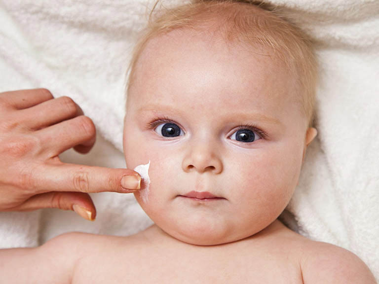Thoa kem dưỡng ẩm để giảm triệu chứng nổi mề đay ở trẻ em