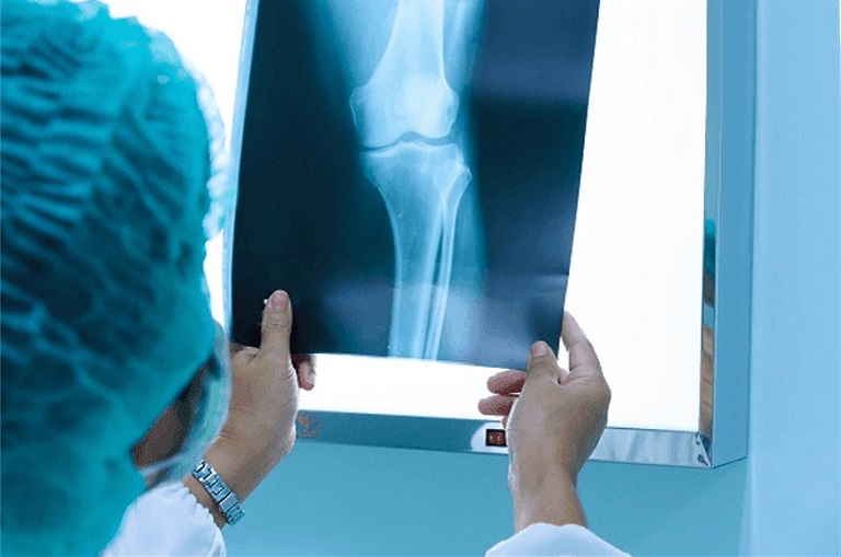 Chụp X-quang để xác định chấn thương