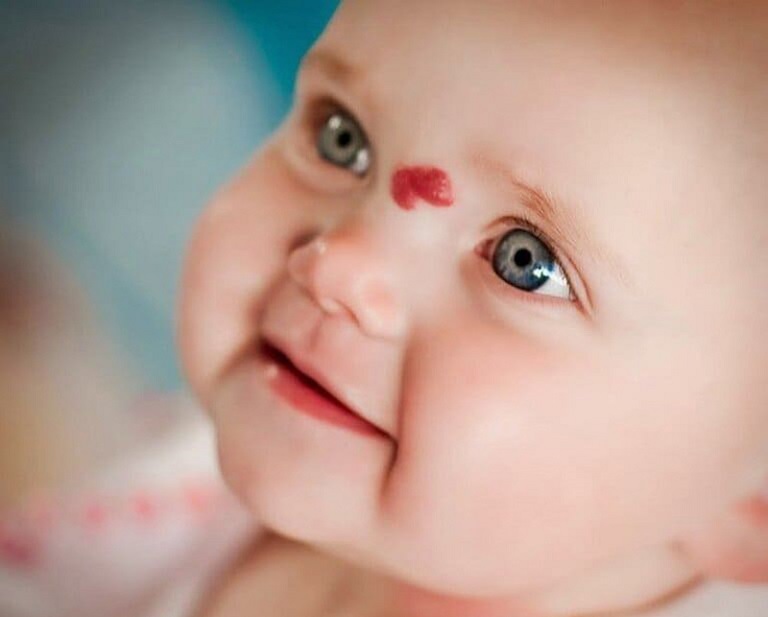 Trẻ vừa chào đời từ 1 đến 4 tuần đầu rất dễ mắc bệnh chàm đỏ