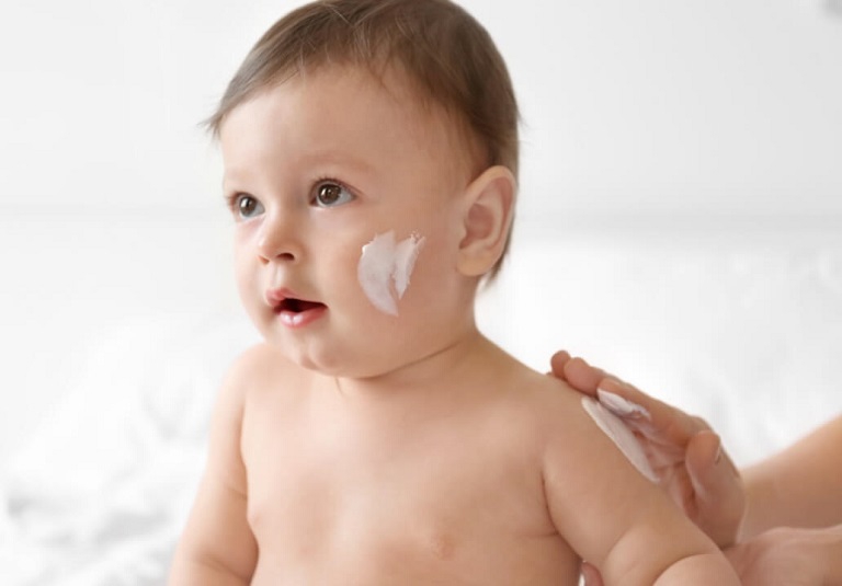 Phụ huynh có thể sử dụng các loại thuốc bôi ngoài da để xử lý bệnh chàm sữa ở trẻ