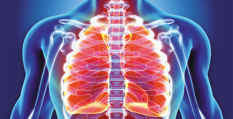 Mũi xương ức nhô cao gây ảnh hưởng đến phổ và tim