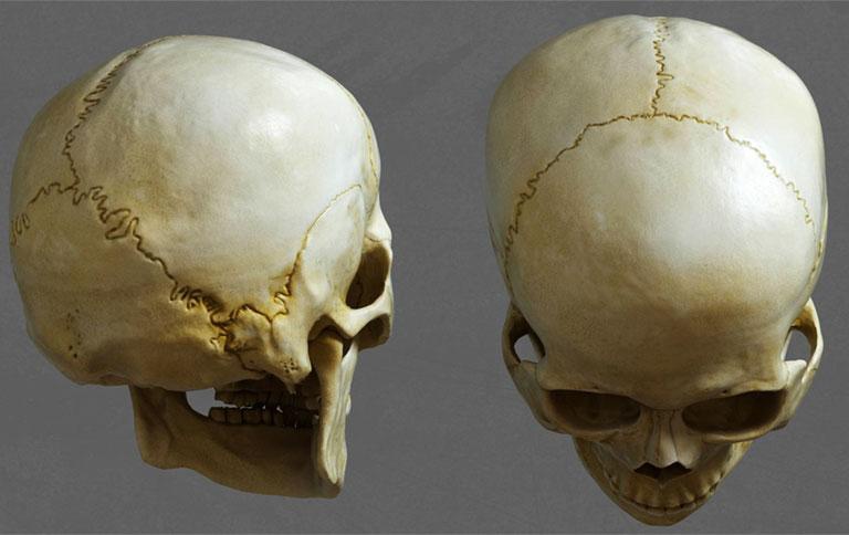 Các xương sọ được giữ với nhau bằng khớp