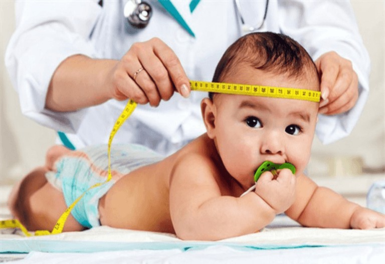 Trẻ sơ sinh thường dễ bị dính khớp xương hộp sọ