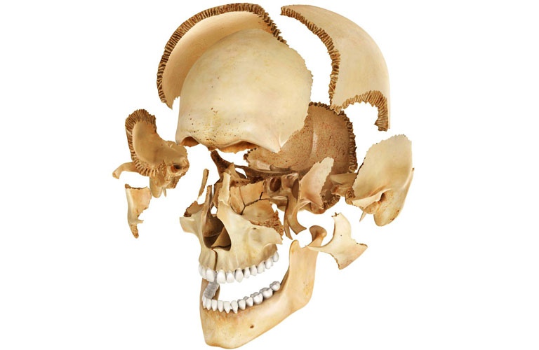 Xương sọ người được cấu tạo bởi 8 xương chính và 7 xương phụ