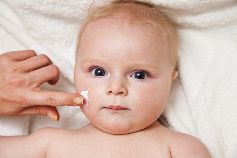 Phụ huynh nên lựa chọn các loại kem dưỡng ẩm lành tính cho bé bị viêm da cơ địa