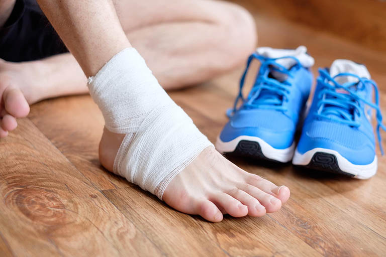 Gãy xương bàn chân có nhiều cách điều trị