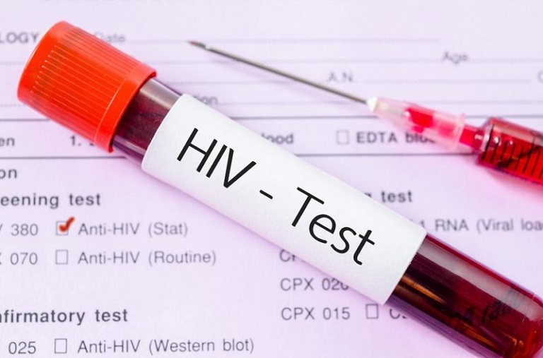 Bạn cần tiến hành làm xét nghiệm để biết chính xác mình có bị nhiễm HIV hay không