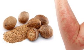 Trị eczema bằng hạt nhục đậu