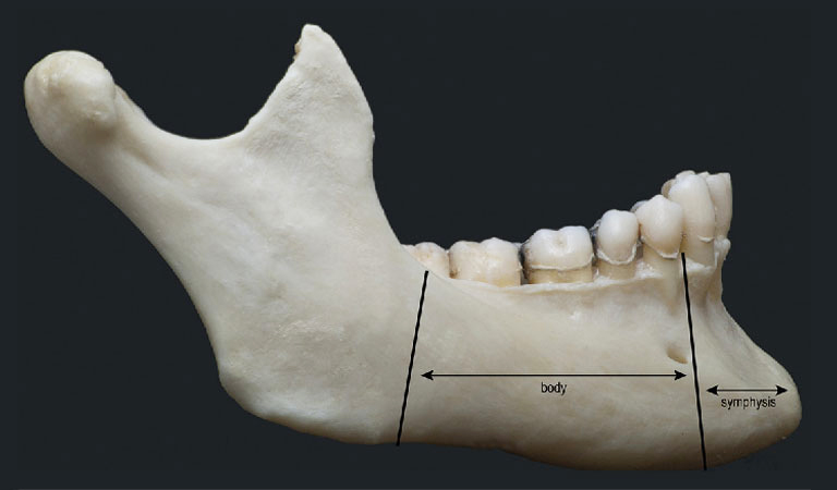 Phần thân và phần nhánh của xương hàm dưới