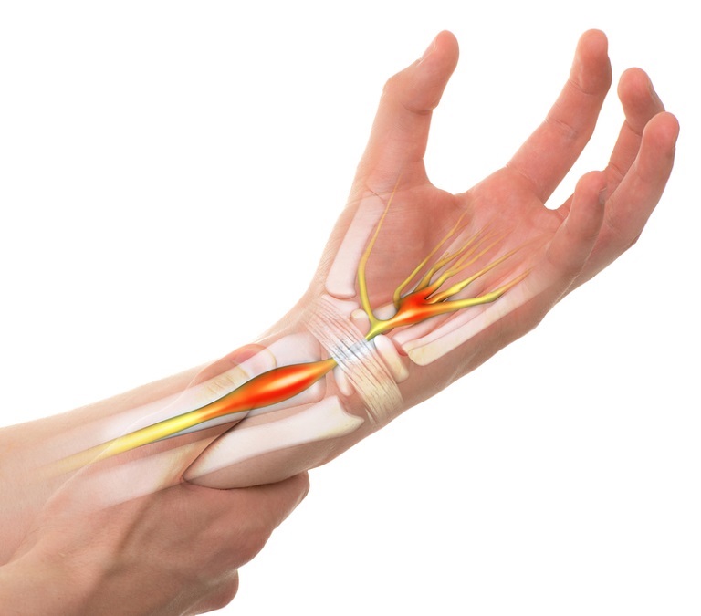 Gân cổ tay cũng là một bộ phận của xương trụ