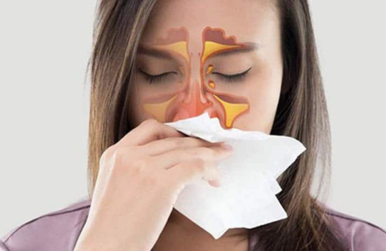 Bệnh hình thành từ tổn thương niêm mạc khoang mũi và lớp niêm mạc bên dưới